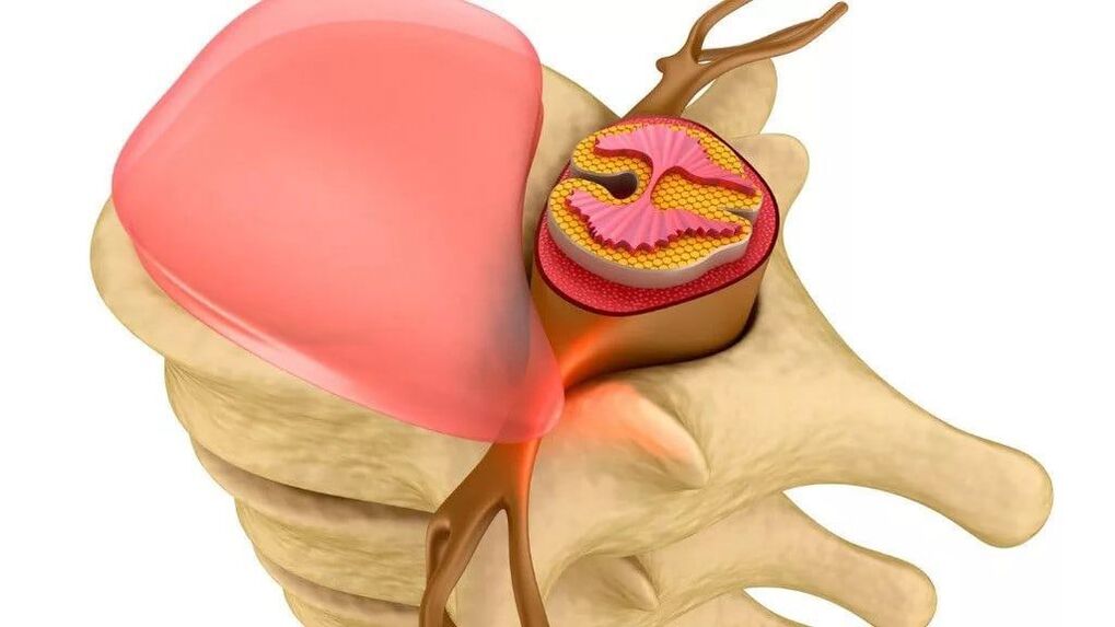 puissance réduite en raison du cancer